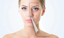 Yanık Ameliyatları Riskleri ve Sonrası Yanık Ameliyatları Riskleri ve Sonrası