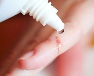 Yanık İzi Yapılması Gerekenler Yanık İzi Yapılması Gerekenler